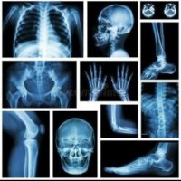 南昌废旧X光片回收公司高价回收曝光处理X光片、医院废CT片、X光片